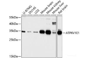 Western blot analysis of extracts of various cell lines using ATP6V1E1 Polyclonal Antibody at dilution of 1:1000. (ATP6V1E1 anticorps)