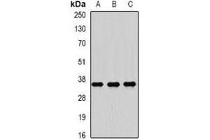Western blot analysis of RASSF1 expression in Hela (A), HepG2 (B), SW480 (C) whole cell lysates. (RASSF1 anticorps)