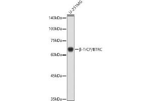 Western blot analysis of extracts of U-251MG cells, using β-TrCP/BTRC antibody (ABIN3022333, ABIN3022334, ABIN3022335 and ABIN6218745) at 1:1000 dilution.