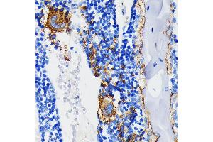 Immunohistochemistry of paraffin-embedded rat bone marrow using Integrin beta 3 (ITGB3/CD61) (ITGB3/CD61) Rabbit mAb (ABIN7267928) at dilution of 1:100 (40x lens). (Integrin beta 3 anticorps)