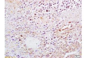 Formalin-fixed and paraffin embedded mouse lymphoma tissue labeled with Anti-Dnmt1 Polyclonal Antibody, Unconjugated  at 1:200, followed by conjugation to the secondary antibody and DAB staining (DNMT1 anticorps  (AA 21-120))
