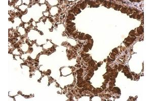 IHC-P Image PCBP2 antibody [N1C1] detects PCBP2 protein at nucleus and cytosol on mouse lung by immunohistochemical analysis.