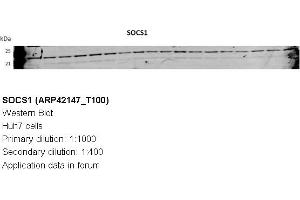 Image no. 3 for anti-Suppressor of Cytokine Signaling 1 (SOCS1) (N-Term) antibody (ABIN310288) (SOCS1 anticorps  (N-Term))