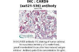 Image no. 1 for anti-Caspase Recruitment Domain Family, Member 9 (CARD9) (AA 521-536) antibody (ABIN1732641) (CARD9 anticorps  (AA 521-536))