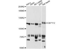 Western blot analysis of extracts of various cell lines, using CEP112 antibody (ABIN6291863) at 1:1000 dilution. (CCDC46 anticorps)