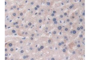 Detection of THBS1 in Mouse Liver Tissue using Polyclonal Antibody to Thrombospondin 1 (THBS1) (Thrombospondin 1 anticorps  (AA 515-671))