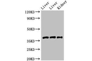 Western Blot Positive WB detected in: Rat liver tissue, Mouse liver tissue, Mouse kidney tissue All lanes: GNB4 antibody at 2 μg/mL Secondary Goat polyclonal to rabbit IgG at 1/50000 dilution Predicted band size: 38 kDa Observed band size: 38 kDa (GNB4 anticorps  (AA 105-185))