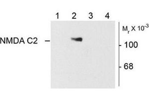Image no. 1 for anti-NMDA Receptor 1 (NMDA R1) (Splice Variant C2) antibody (ABIN372676)