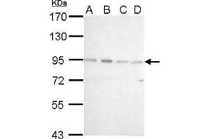 WB Image CSDE1 antibody [N2C1], Internal detects CSDE1 protein by Western blot analysis. (CDSE1 anticorps  (Internal Region))