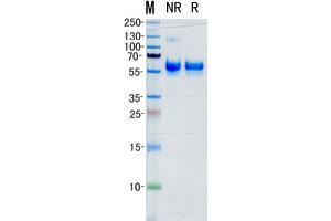 Validation with Western Blot