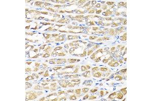 Immunohistochemistry of paraffin-embedded rat stomach using IKBKAP Rabbit pAb (ABIN6130369, ABIN6142278, ABIN6142279 and ABIN6214265) at dilution of 1:100 (40x lens).