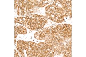 anti-Y Box Binding Protein 1 (YBX1) (AA 224-274) antibody