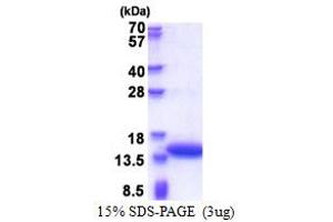 SDS-PAGE (SDS) image for Calponin 2 (CNN2) (AA 1-131) protein (His tag) (ABIN5853570) (CNN2 Protein (AA 1-131) (His tag))