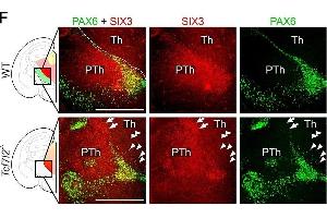 TCF7L2 controls the establishment of anatomical borders in the thalamus and habenula. (SIX3 anticorps  (Internal Region))