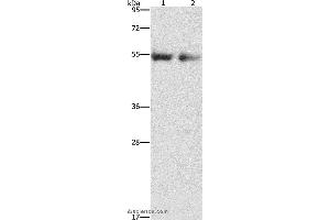 Western blot analysis of Human right lung and left lung cancer tissue, using ANGPT4 Polyclonal Antibody at dilution of 1:480 (Angiopoietin 4 anticorps)