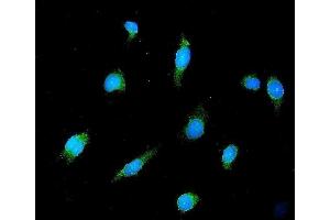 IF analysis of GAD65/GAD2 using anti-GAD65/GAD2 antibody (ABIN7603170).