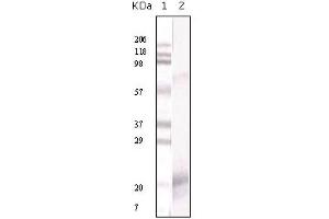 Western Blotting (WB) image for anti-Interferon gamma (IFNG) antibody (ABIN1107642) (Interferon gamma anticorps)