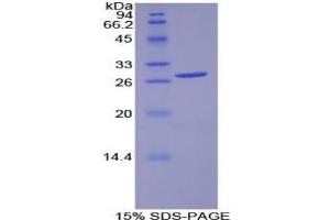 SDS-PAGE analysis of Human PDK1 Protein. (PDK1 Protéine)