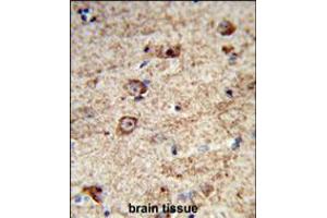 Formalin-fixed and paraffin-embedded human brain tissue reacted with LRRC4 Antibody , which was peroxidase-conjugated to the secondary antibody, followed by DAB staining. (LRRC4 anticorps  (C-Term))