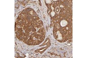 Immunohistochemical staining of human pancreas with DPYSL2 polyclonal antibody  shows cytoplasmic positivity in islet cells at 1:500-1:1000 dilution. (DPYSL2 anticorps)