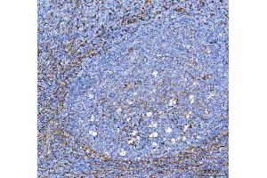 IHC analysis of S100A10 using anti-S100A10 antibody (ABIN5692833).