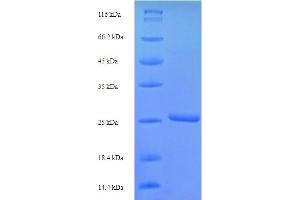 SDS-PAGE (SDS) image for Stimulator of Chondrogenesis 1 (SCRG1) (AA 21-98) protein (His-SUMO Tag) (ABIN5711221)