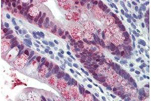 Small intestine, Human: Formalin-Fixed, Paraffin-Embedded (FFPE)