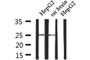 Western blot analysis of extracts from HepG2 and rat brain, using SOCS3 Antibody. (SOCS3 anticorps  (C-Term))