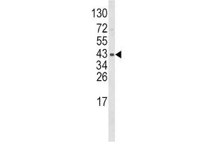 Western Blotting (WB) image for anti-Wingless-Type MMTV Integration Site Family, Member 5B (WNT5B) antibody (ABIN3003826)