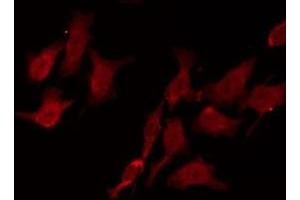 ABIN6275000 staining HepG2 by IF/ICC.