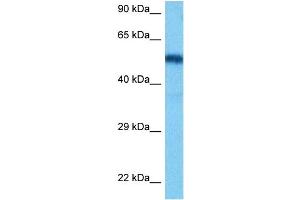 Host:  Rat  Target Name:  HNF1B  Sample Tissue:  Rat Liver  Antibody Dilution:  1ug/ml (HNF1B anticorps  (N-Term))