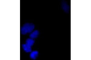 Immunofluorescence (IF) image for anti-Small Ubiquitin Related Modifier Protein 1 (SUMO1) (full length) antibody (FITC) (ABIN2452136)