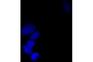 Immunofluorescence (IF) image for anti-Small Ubiquitin Related Modifier Protein 1 (SUMO1) (full length) antibody (FITC) (ABIN2452136) (SUMO1 anticorps  (full length) (FITC))