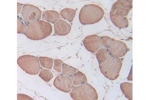 IHC-P analysis of skeletal muscle tissue, with DAB staining. (Triadin anticorps  (AA 486-687))