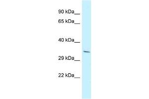 Host: Rabbit Target Name: PDLIM7 Sample Type: NCI-H226 Whole Cell lysates Antibody Dilution: 1. (PDLIM7 anticorps  (N-Term))