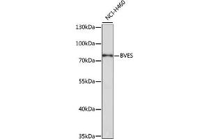 Western blot analysis of extracts of NCI-H460 cells, using BVES antibody (ABIN3020695, ABIN3020696, ABIN1512652 and ABIN6213674) at 1:1000 dilution. (BVES anticorps  (AA 241-360))