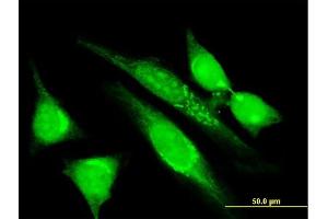 Immunofluorescence of monoclonal antibody to MGRN1 on HeLa cell. (Mahogunin RING Finger Protein 1 anticorps  (AA 477-576))