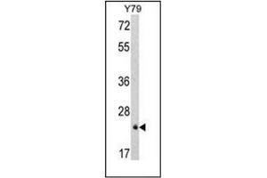 Western blot analysis of GSTP1 Antibody (C-term) in Y79 cell line lysates (35ug/lane).