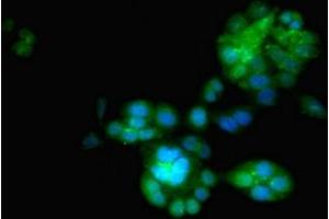 Immunofluorescent analysis of PC-3 cells using ABIN7151444 at dilution of 1:100 and Alexa Fluor 488-congugated AffiniPure Goat Anti-Rabbit IgG(H+L)