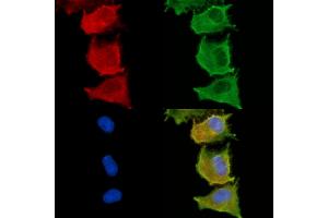 ABIN6263325 and ABIN6279013 staining  cells by IF/ICC. (MOGAT3 anticorps  (C-Term))