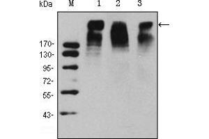 Western blot analysis using KI67 mouse mAb against Hela (1), MCF-7 (2) and Raji (3) cell lysate. (Ki-67 anticorps)