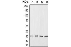 Western blot analysis of ANKRD1 expression in HeLa (A), Jurkat (B), NIH3T3 (C), H9C2 (D) whole cell lysates. (ANKRD1 anticorps  (C-Term))