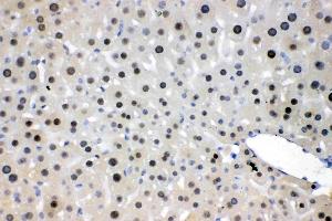 IHC analysis of NFIA using anti- NFIA antibody .