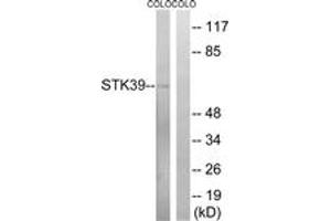 Western blot analysis of extracts from COLO cells, using STK39 (Ab-325) Antibody. (STK39 anticorps  (AA 291-340))