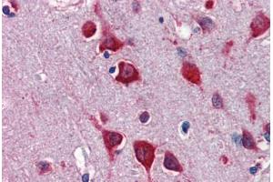 Human Brain, Cortex (formalin-fixed, paraffin-embedded) stained with TBX5 antibody ABIN462189 followed by biotinylated goat anti-rabbit IgG secondary antibody ABIN481713, alkaline phosphatase-streptavidin and chromogen.