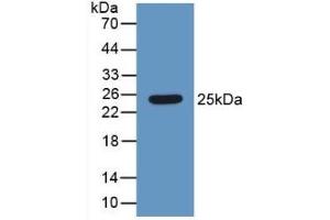 Detection of Recombinant HMG1, Human using Polyclonal Antibody to High Mobility Group Protein 1 (HMGB1) (HMGB1 anticorps  (AA 1-215))
