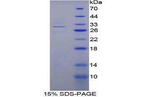 SDS-PAGE analysis of Mouse Fibrinogen alpha Protein. (FGA Protéine)