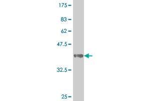 Western Blot detection against Immunogen (39.