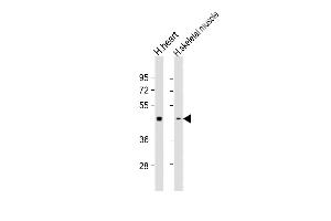 All lanes : Anti- at 1:1000 dilution Lane 1: human heart lysate Lane 2: human skeletal muscle lysate Lysates/proteins at 20 μg per lane. (PDK2 anticorps)