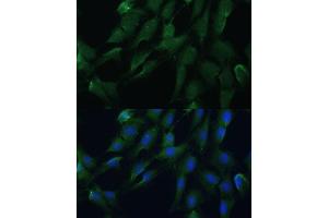 Immunofluorescence analysis of C6 cells using DRG2 antibody (ABIN7266746) at dilution of 1:100. (DRG2 anticorps  (AA 150-260))